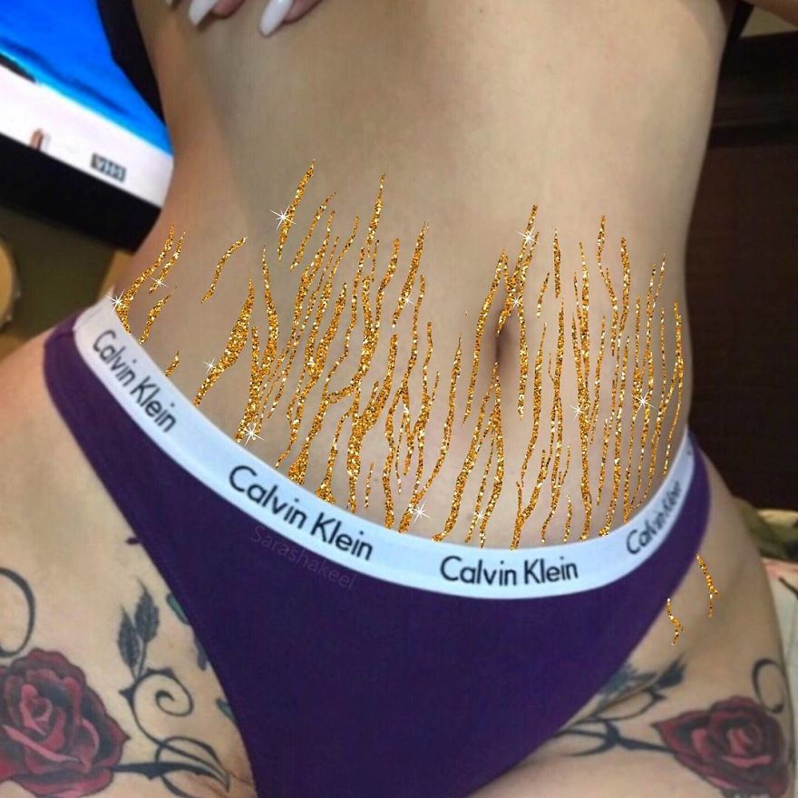 Artist Turns Stretch Marks Into Art In Order To Encourage People To Be Proud Of Them