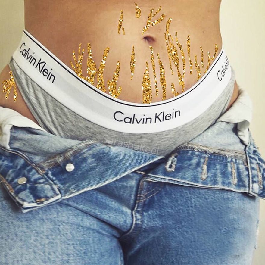 Artist Turns Stretch Marks Into Art In Order To Encourage People To Be Proud Of Them