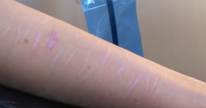 19-Year-Old Wanted To Cover Up Her Self-Harm Scars But All Tattoo Artists Refused To Help. Except One 19-Year-Old Wanted To Cover Up Her Self-Harm Scars But All Tattoo Artists Refused To Help. Except One
