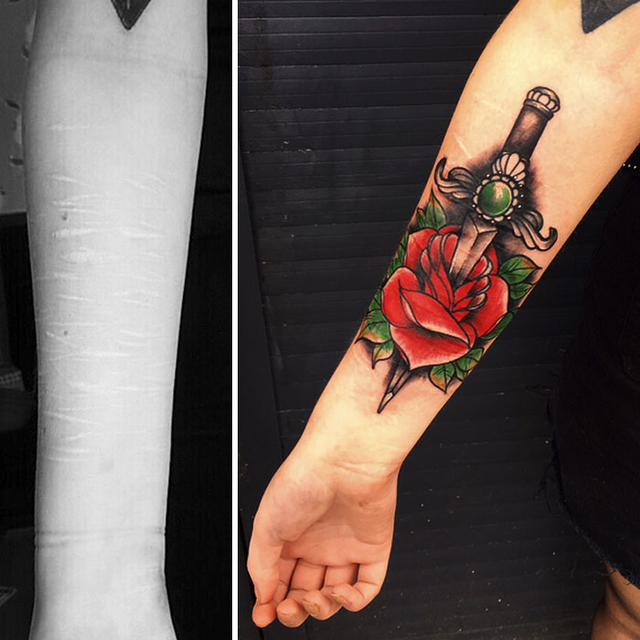 19-Year-Old Wanted To Cover Up Her Self-Harm Scars But All Tattoo Artists Refused To Help. Except One 19-Year-Old Wanted To Cover Up Her Self-Harm Scars But All Tattoo Artists Refused To Help. Except One