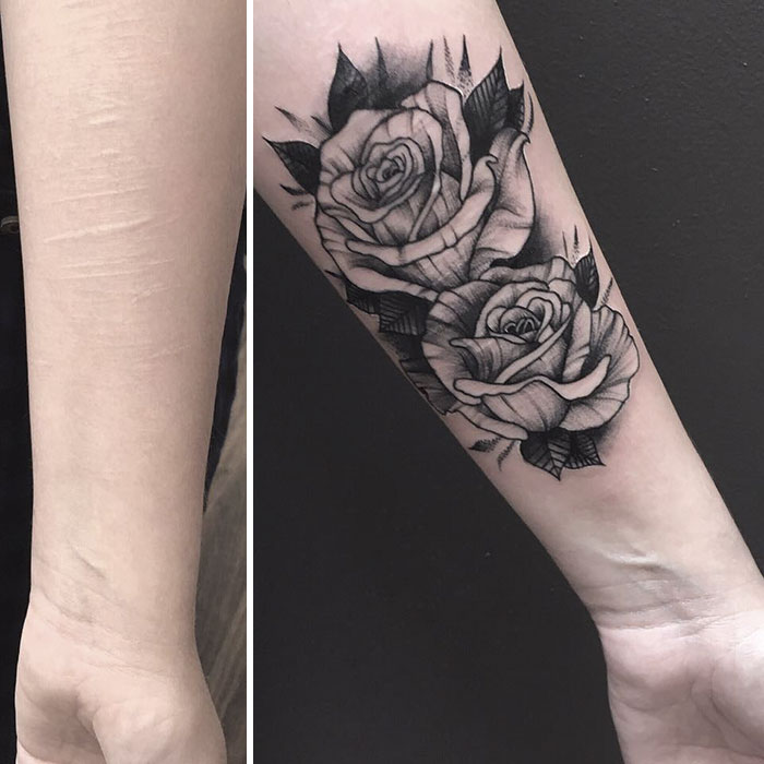 19-Year-Old Wanted To Cover Up Her Self-Harm Scars But All Tattoo Artists Refused To Help. Except One 19-Year-Old Wanted To Cover Up Her Self-Harm Scars But All Tattoo Artists Refused To Help. Except One