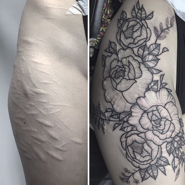 19-Year-Old Wanted To Cover Up Her Self-Harm Scars But All Tattoo Artists Refused To Help. Except One 19-Year-Old Wanted To Cover Up Her Self-Harm Scars But All Tattoo Artists Refused To Help. Except One