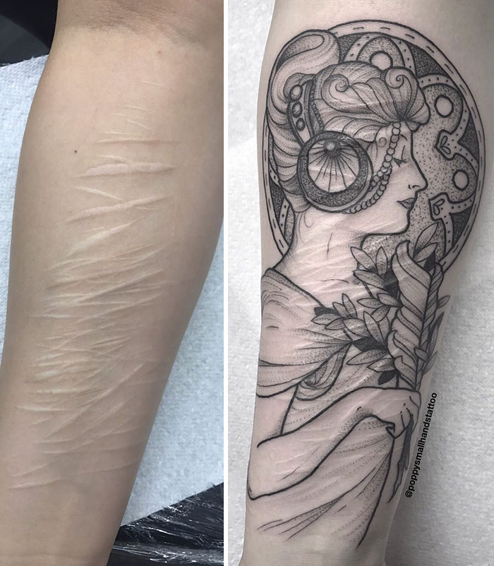19-Year-Old Wanted To Cover Up Her Self-Harm Scars But All Tattoo Artists Refused To Help. Except One 19-Year-Old Wanted To Cover Up Her Self-Harm Scars But All Tattoo Artists Refused To Help. Except One