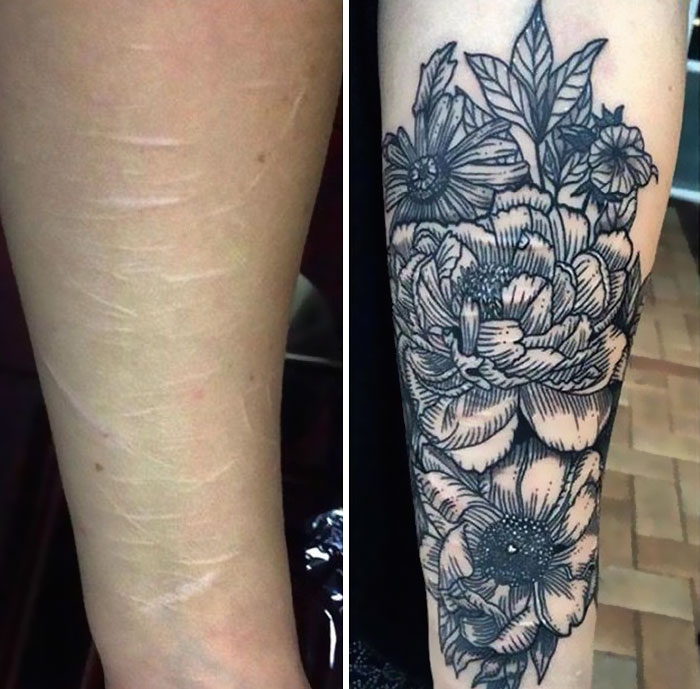 19-Year-Old Wanted To Cover Up Her Self-Harm Scars But All Tattoo Artists Refused To Help. Except One 19-Year-Old Wanted To Cover Up Her Self-Harm Scars But All Tattoo Artists Refused To Help. Except One
