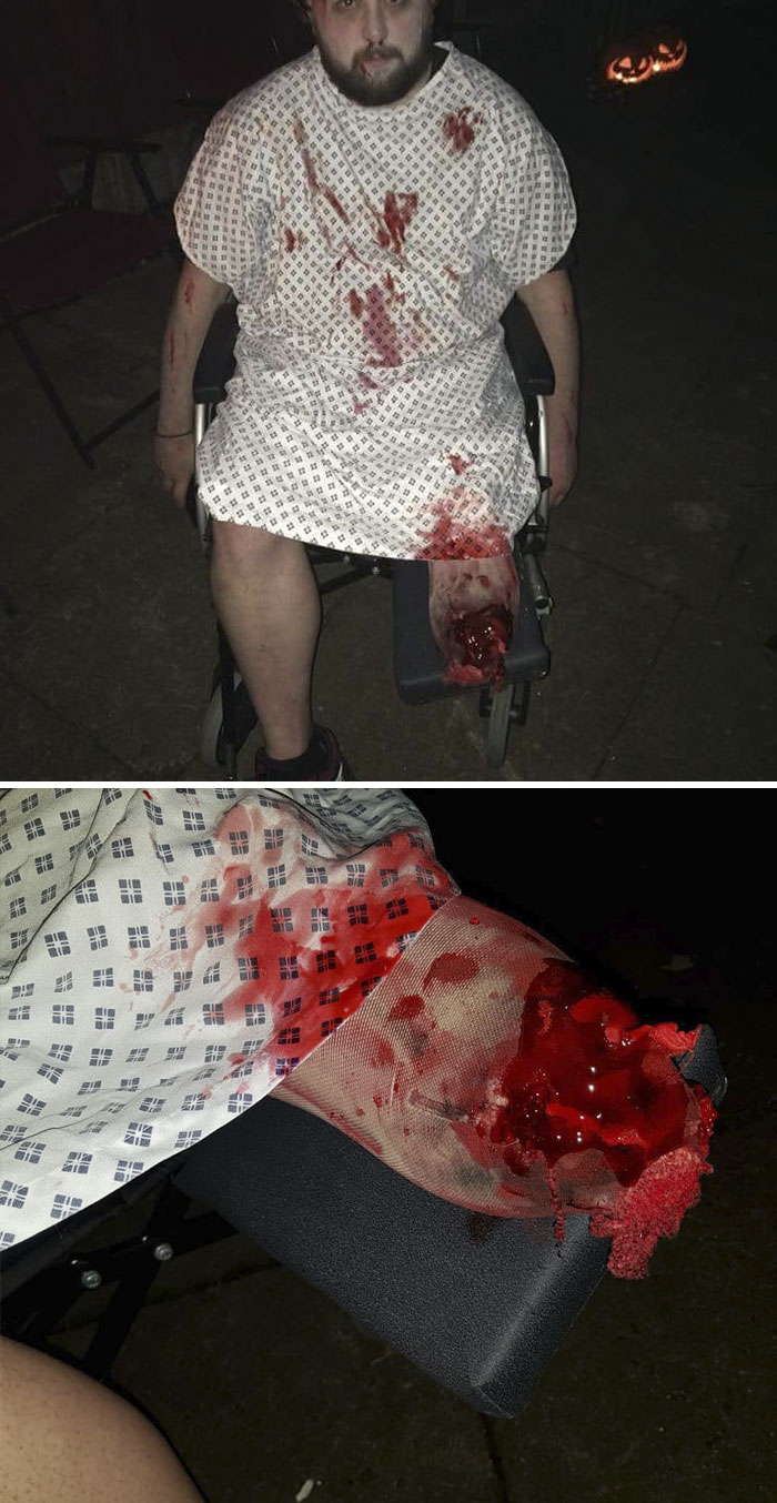 50 Times People With Disabilities Won Halloween With Their Awesome Sense Of Humor