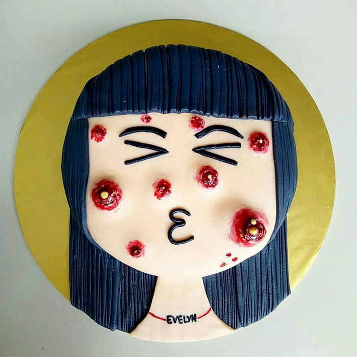 This Cake Has Poppable Pimples, And We Can’t Look Away Even Though We Want To This Cake Has Poppable Pimples, And We Can’t Look Away Even Though We Want To