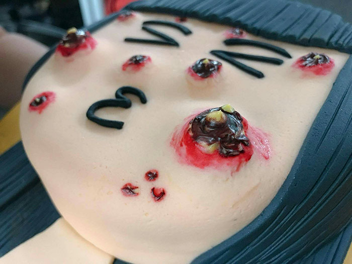This Cake Has Poppable Pimples, And We Can’t Look Away Even Though We Want To This Cake Has Poppable Pimples, And We Can’t Look Away Even Though We Want To