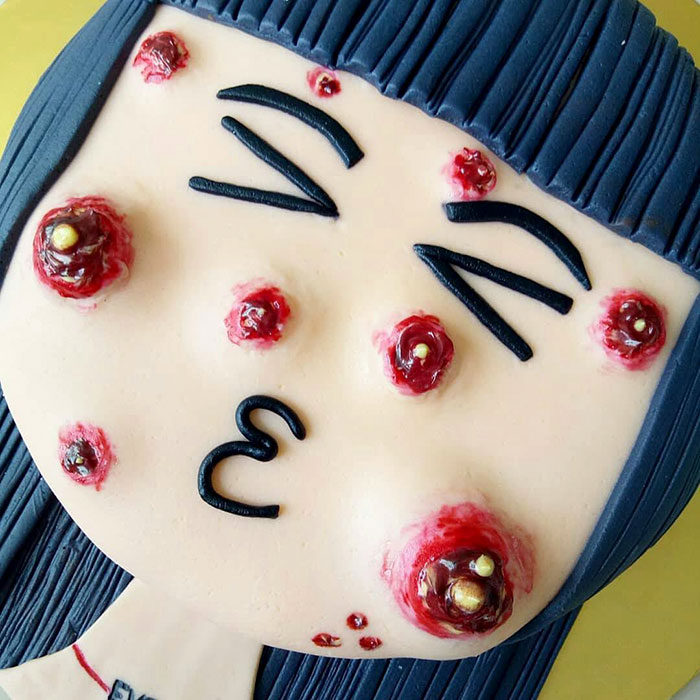 This Cake Has Poppable Pimples, And We Can’t Look Away Even Though We Want To This Cake Has Poppable Pimples, And We Can’t Look Away Even Though We Want To