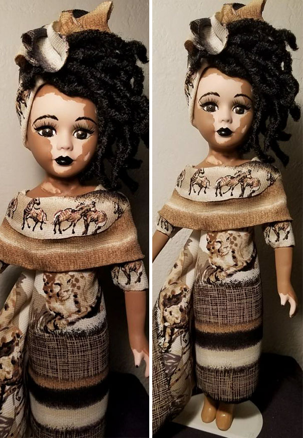 Artist Creates Dolls With Vitiligo For Kids With This Rare Skin Condition Artist Creates Dolls With Vitiligo For Kids With This Rare Skin Condition