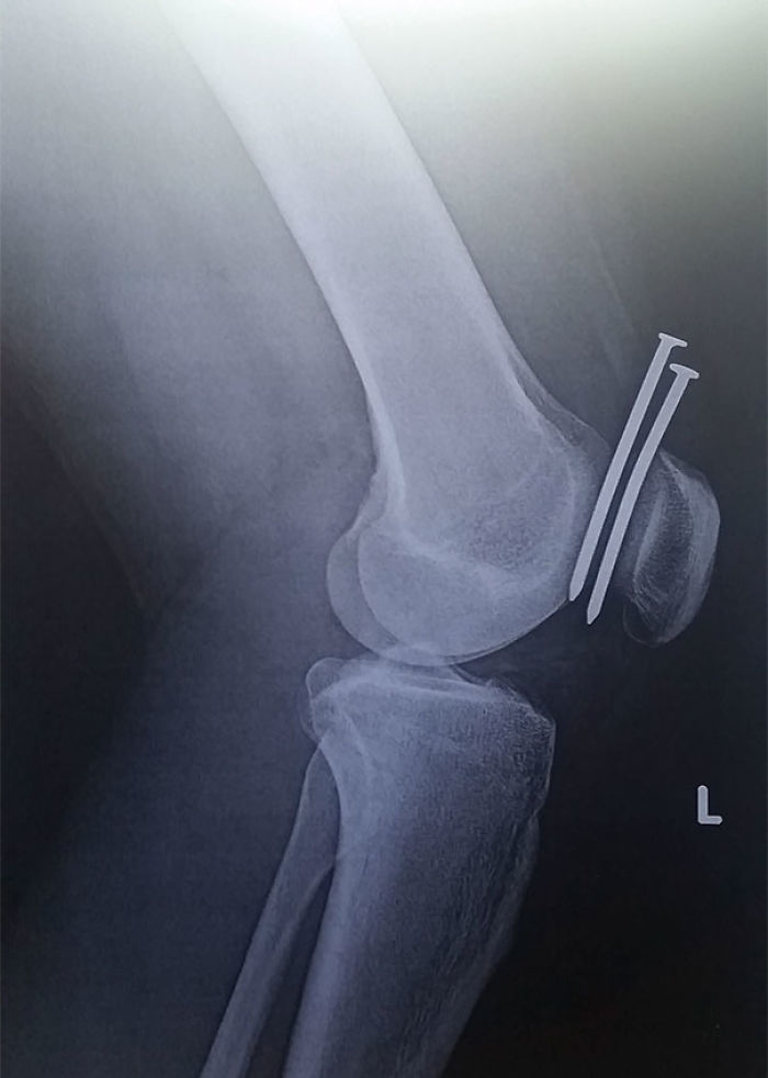 109 One In A Million Coincidences That Are Hard To Believe Have Actually Happened 109 One In A Million Coincidences That Are Hard To Believe Have Actually Happened