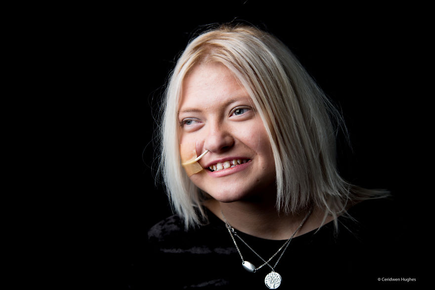 Through These Photos I Want To Encourage More People To Find Out About Rare Disease And The Impact It Has On The People Around Them Through These Photos I Want To Encourage More People To Find Out About Rare Disease And The Impact It Has On The People Around Them