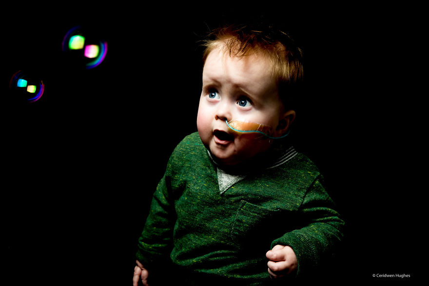 Through These Photos I Want To Encourage More People To Find Out About Rare Disease And The Impact It Has On The People Around Them Through These Photos I Want To Encourage More People To Find Out About Rare Disease And The Impact It Has On The People Around Them