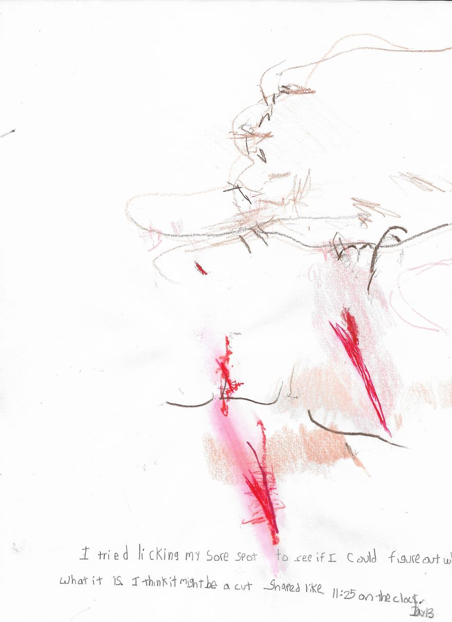 30 Days Totally Blind 30 Days Totally Blind