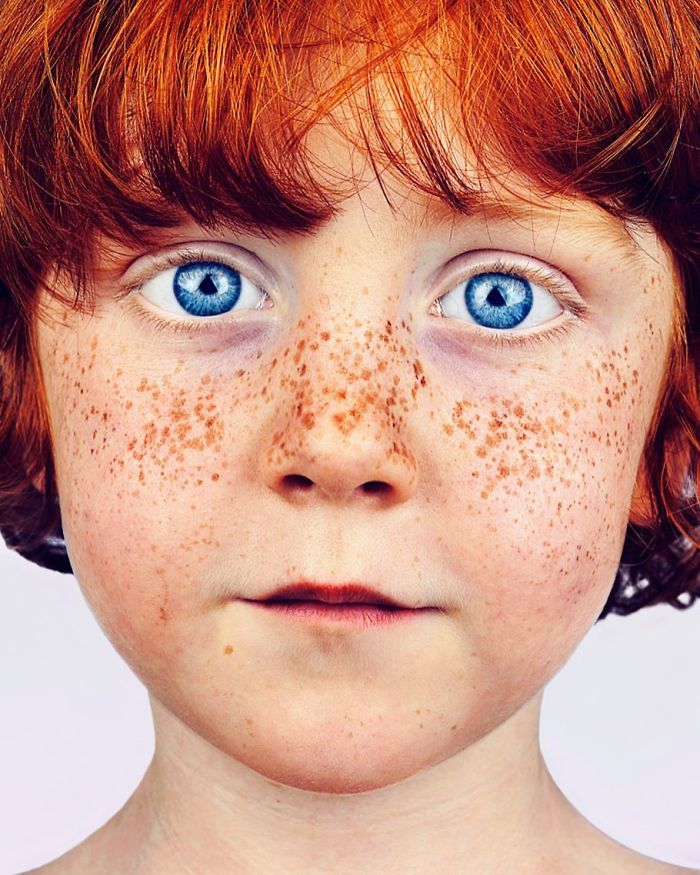 Photographer Takes Portraits Of Freckled People To Celebrate Their Unique Beauty Photographer Takes Portraits Of Freckled People To Celebrate Their Unique Beauty