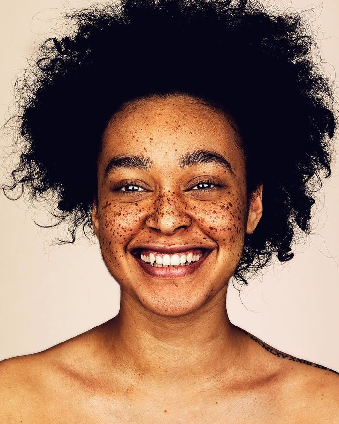 Photographer Takes Portraits Of Freckled People To Celebrate Their Unique Beauty Photographer Takes Portraits Of Freckled People To Celebrate Their Unique Beauty