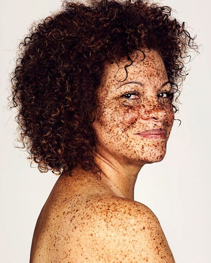 Photographer Takes Portraits Of Freckled People To Celebrate Their Unique Beauty Photographer Takes Portraits Of Freckled People To Celebrate Their Unique Beauty