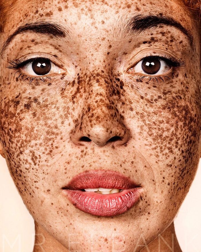 Photographer Takes Portraits Of Freckled People To Celebrate Their Unique Beauty Photographer Takes Portraits Of Freckled People To Celebrate Their Unique Beauty