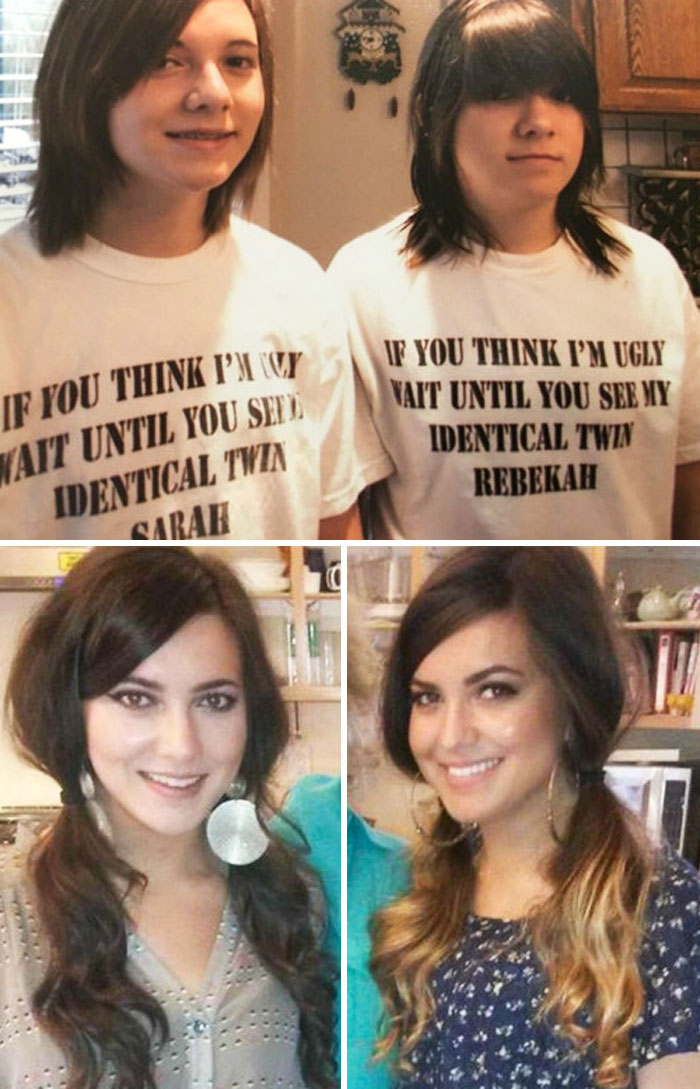 People Who Used To Be “Ugly Ducklings” Share Their Transformations, And We Can Barely Recognize Them (New Pics) People Who Used To Be “Ugly Ducklings” Share Their Transformations, And We Can Barely Recognize Them (New Pics)