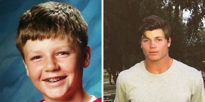 People Who Used To Be “Ugly Ducklings” Share Their Transformations, And We Can Barely Recognize Them (New Pics) People Who Used To Be “Ugly Ducklings” Share Their Transformations, And We Can Barely Recognize Them (New Pics)