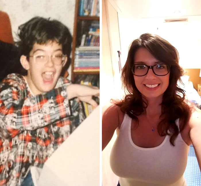 People Who Used To Be “Ugly Ducklings” Share Their Transformations, And We Can Barely Recognize Them (New Pics) People Who Used To Be “Ugly Ducklings” Share Their Transformations, And We Can Barely Recognize Them (New Pics)