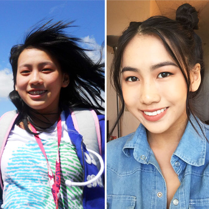 People Who Used To Be “Ugly Ducklings” Share Their Transformations, And We Can Barely Recognize Them (New Pics) People Who Used To Be “Ugly Ducklings” Share Their Transformations, And We Can Barely Recognize Them (New Pics)