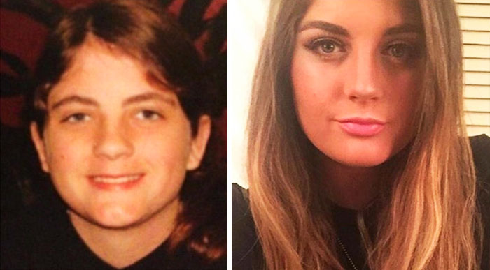 People Who Used To Be “Ugly Ducklings” Share Their Transformations, And We Can Barely Recognize Them (New Pics) People Who Used To Be “Ugly Ducklings” Share Their Transformations, And We Can Barely Recognize Them (New Pics)