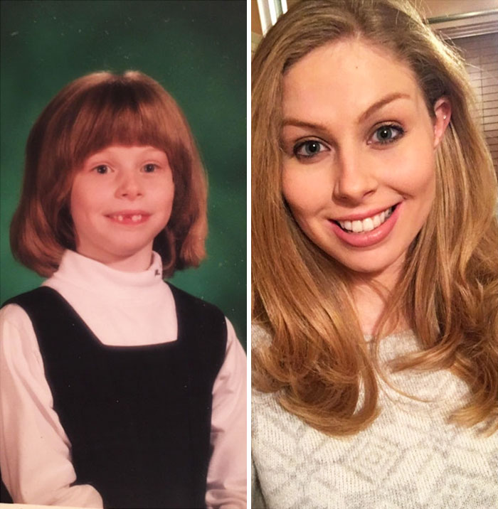 People Who Used To Be “Ugly Ducklings” Share Their Transformations, And We Can Barely Recognize Them (New Pics) People Who Used To Be “Ugly Ducklings” Share Their Transformations, And We Can Barely Recognize Them (New Pics)
