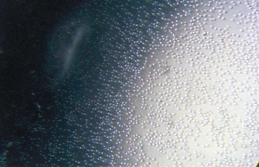 I Find Cosmos Under My Microscope And With Microbial Plate – Microsmos I Find Cosmos Under My Microscope And With Microbial Plate – Microsmos