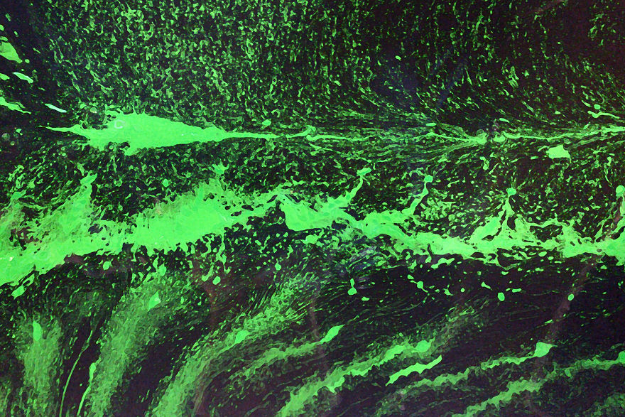 Is Waste Just A Waste? Story Of 69+ Canvas That Make Friends