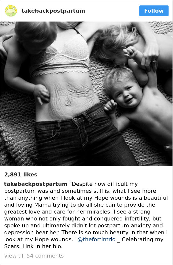 90 Brutally Honest Photos Of Post-Baby Bodies, That Women Are Sharing To Reveal The Truth No One Talks About 90 Brutally Honest Photos Of Post-Baby Bodies, That Women Are Sharing To Reveal The Truth No One Talks About