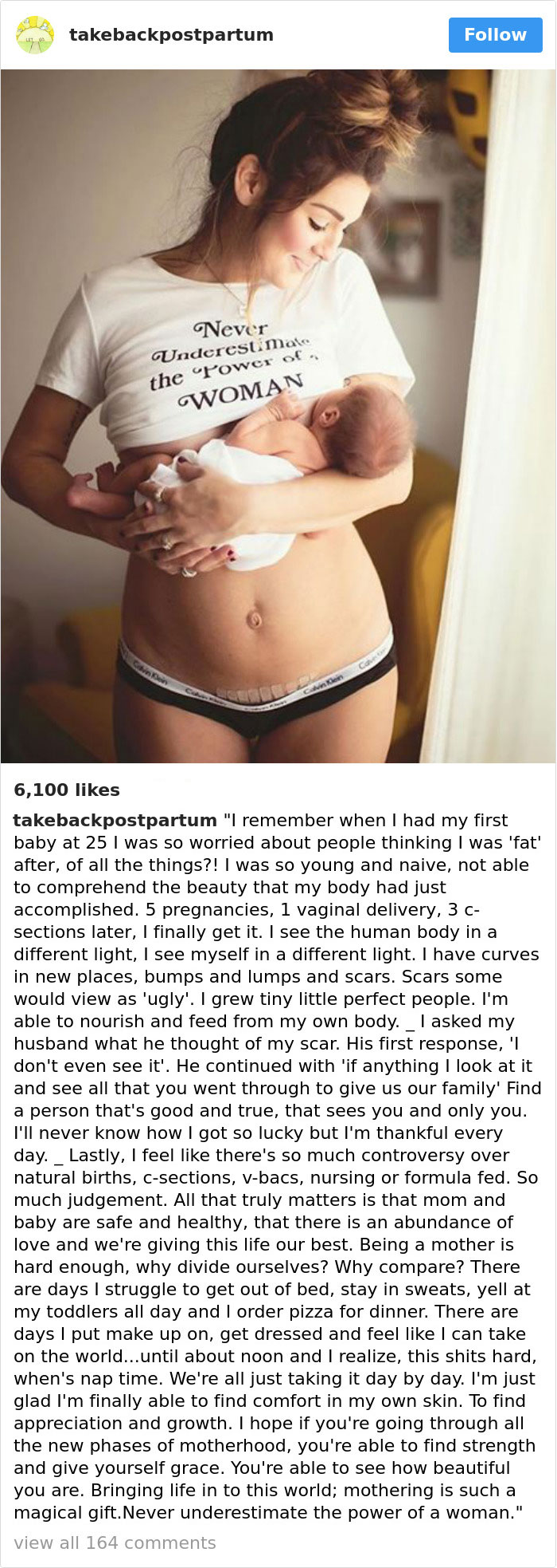 90 Brutally Honest Photos Of Post-Baby Bodies, That Women Are Sharing To Reveal The Truth No One Talks About 90 Brutally Honest Photos Of Post-Baby Bodies, That Women Are Sharing To Reveal The Truth No One Talks About