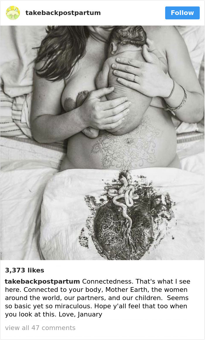 90 Brutally Honest Photos Of Post-Baby Bodies, That Women Are Sharing To Reveal The Truth No One Talks About 90 Brutally Honest Photos Of Post-Baby Bodies, That Women Are Sharing To Reveal The Truth No One Talks About