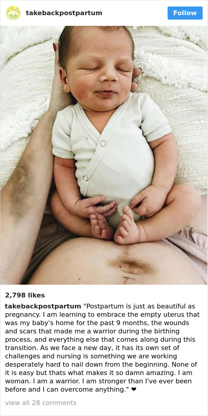 90 Brutally Honest Photos Of Post-Baby Bodies, That Women Are Sharing To Reveal The Truth No One Talks About 90 Brutally Honest Photos Of Post-Baby Bodies, That Women Are Sharing To Reveal The Truth No One Talks About