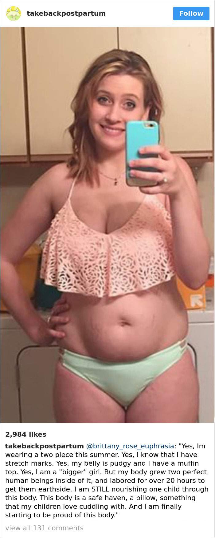 90 Brutally Honest Photos Of Post-Baby Bodies, That Women Are Sharing To Reveal The Truth No One Talks About 90 Brutally Honest Photos Of Post-Baby Bodies, That Women Are Sharing To Reveal The Truth No One Talks About
