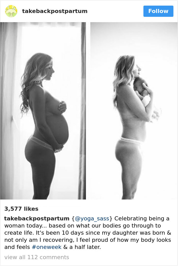 90 Brutally Honest Photos Of Post-Baby Bodies, That Women Are Sharing To Reveal The Truth No One Talks About 90 Brutally Honest Photos Of Post-Baby Bodies, That Women Are Sharing To Reveal The Truth No One Talks About