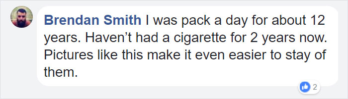 Shocking Video Of Nurse Inflating Healthy Lungs Vs Smoker’s Reveals What Cigarettes Really Do To You Shocking Video Of Nurse Inflating Healthy Lungs Vs Smoker’s Reveals What Cigarettes Really Do To You