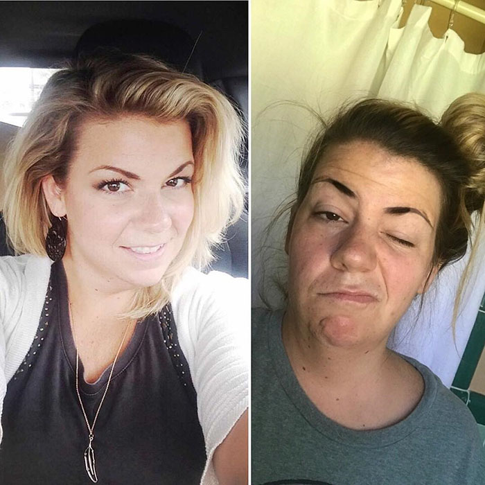 Got Toddlered: Parents Share Photos Of Them Before And After Having Kids, And The Difference Is Hilarious Got Toddlered: Parents Share Photos Of Them Before And After Having Kids, And The Difference Is Hilarious