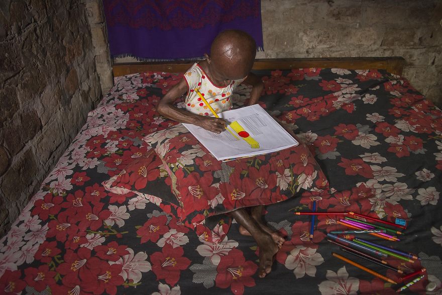 Doctors Gave This Girl 3 More Years To Live, And She’s Becoming An Example On How To Enjoy Life Doctors Gave This Girl 3 More Years To Live, And She’s Becoming An Example On How To Enjoy Life