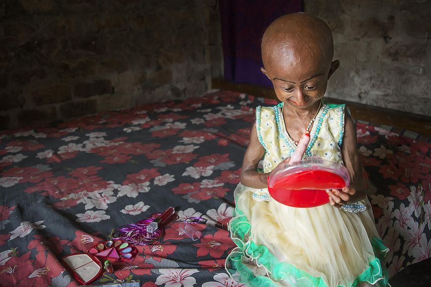 Doctors Gave This Girl 3 More Years To Live, And She’s Becoming An Example On How To Enjoy Life Doctors Gave This Girl 3 More Years To Live, And She’s Becoming An Example On How To Enjoy Life