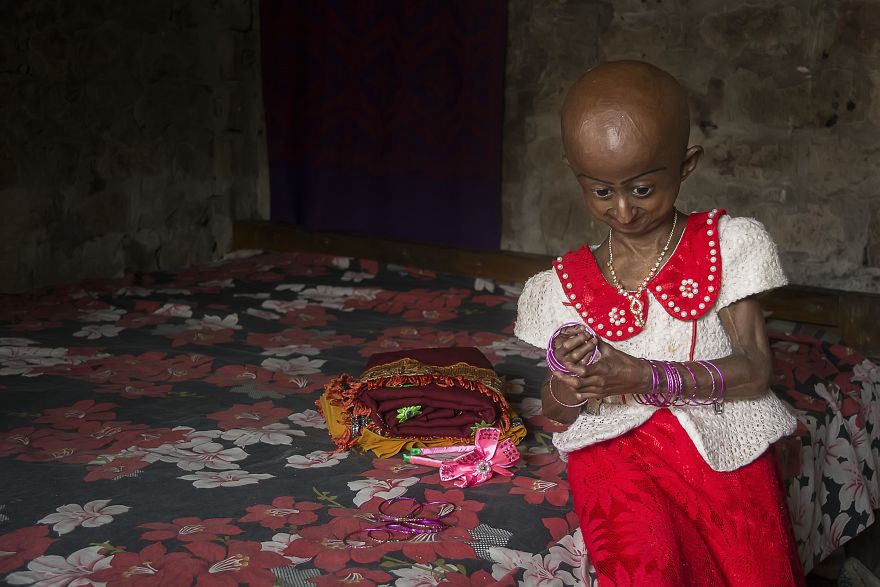 Doctors Gave This Girl 3 More Years To Live, And She’s Becoming An Example On How To Enjoy Life Doctors Gave This Girl 3 More Years To Live, And She’s Becoming An Example On How To Enjoy Life