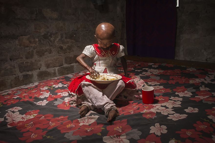 Doctors Gave This Girl 3 More Years To Live, And She’s Becoming An Example On How To Enjoy Life Doctors Gave This Girl 3 More Years To Live, And She’s Becoming An Example On How To Enjoy Life