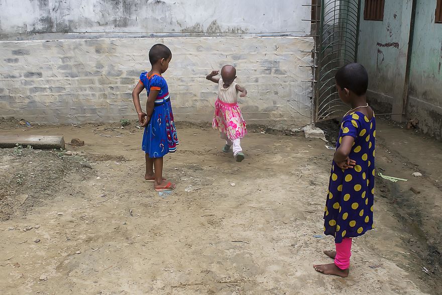 Doctors Gave This Girl 3 More Years To Live, And She’s Becoming An Example On How To Enjoy Life Doctors Gave This Girl 3 More Years To Live, And She’s Becoming An Example On How To Enjoy Life