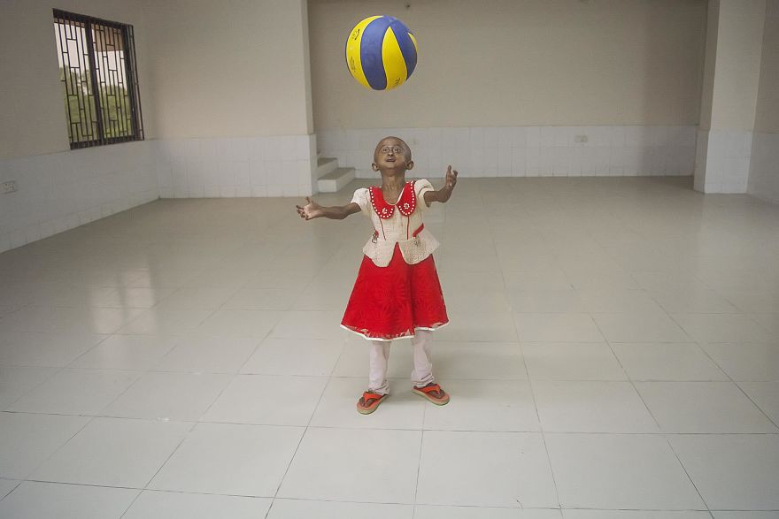 Doctors Gave This Girl 3 More Years To Live, And She’s Becoming An Example On How To Enjoy Life Doctors Gave This Girl 3 More Years To Live, And She’s Becoming An Example On How To Enjoy Life