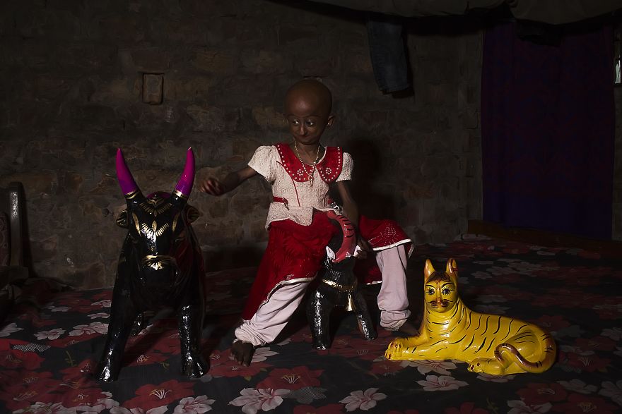 Doctors Gave This Girl 3 More Years To Live, And She’s Becoming An Example On How To Enjoy Life Doctors Gave This Girl 3 More Years To Live, And She’s Becoming An Example On How To Enjoy Life