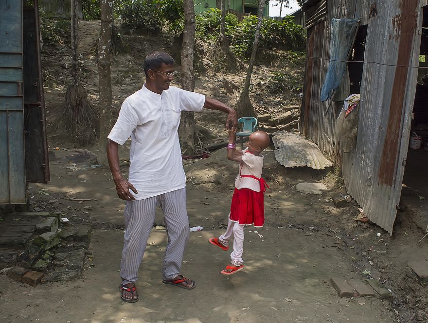 Doctors Gave This Girl 3 More Years To Live, And She’s Becoming An Example On How To Enjoy Life Doctors Gave This Girl 3 More Years To Live, And She’s Becoming An Example On How To Enjoy Life