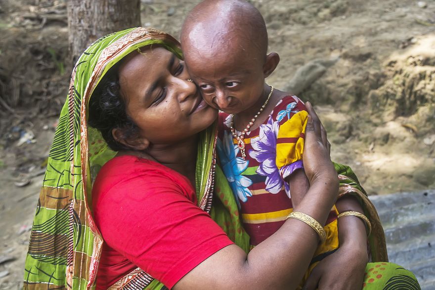 Doctors Gave This Girl 3 More Years To Live, And She’s Becoming An Example On How To Enjoy Life Doctors Gave This Girl 3 More Years To Live, And She’s Becoming An Example On How To Enjoy Life