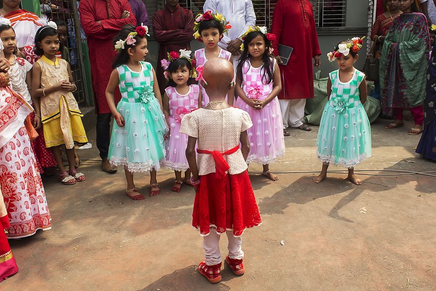 Doctors Gave This Girl 3 More Years To Live, And She’s Becoming An Example On How To Enjoy Life Doctors Gave This Girl 3 More Years To Live, And She’s Becoming An Example On How To Enjoy Life