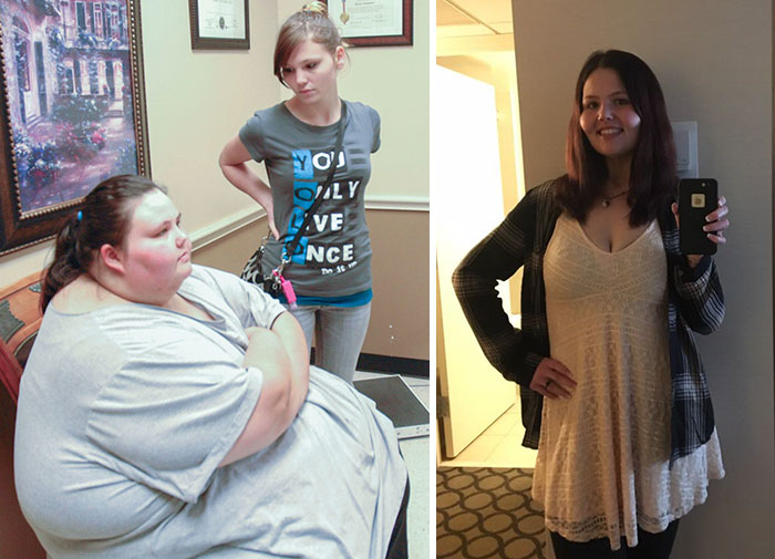 25 Unbelievable Before & After Transformation Pics From ‘My 600 Lb Life’ 25 Unbelievable Before & After Transformation Pics From ‘My 600 Lb Life’