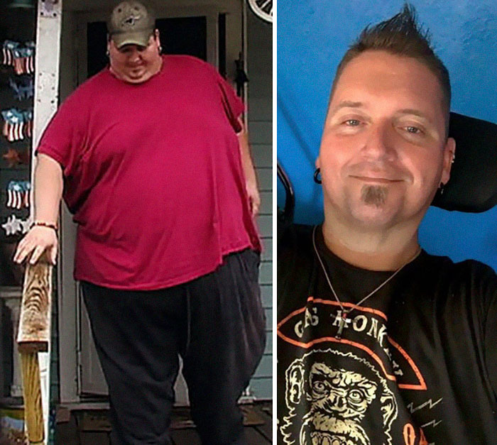 25 Unbelievable Before & After Transformation Pics From ‘My 600 Lb Life’ 25 Unbelievable Before & After Transformation Pics From ‘My 600 Lb Life’