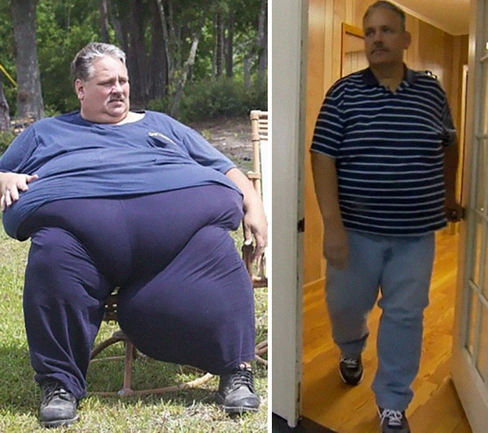 25 Unbelievable Before & After Transformation Pics From ‘My 600 Lb Life’ 25 Unbelievable Before & After Transformation Pics From ‘My 600 Lb Life’